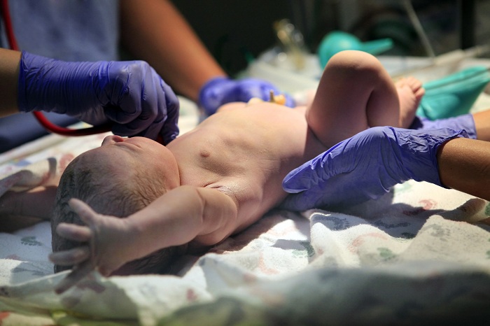 Birth Complications Are Reason For Medical Malpractice